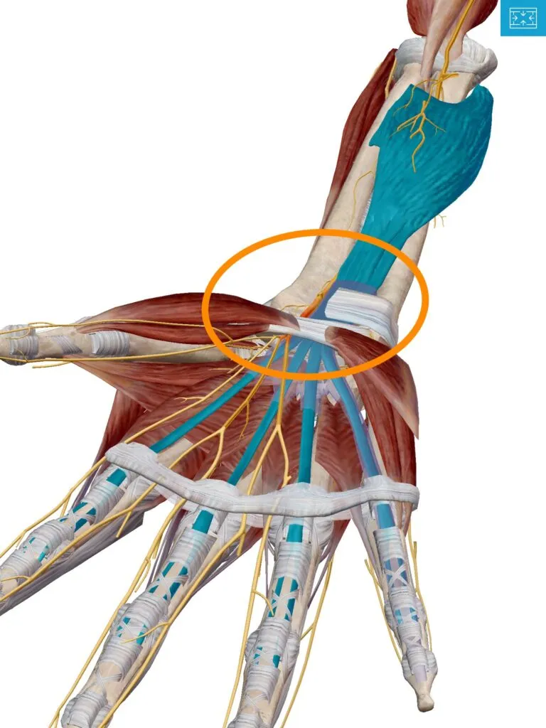 Carpal tunnel syndrome treatment in Plymouth, MI