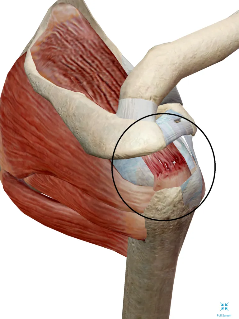 Shoulder joint anatomy render with a circled area at the rotator cuff tendon attachment