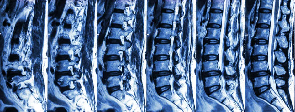 Save Time. Save Money. Get Peace of Mind: Skip the MRI