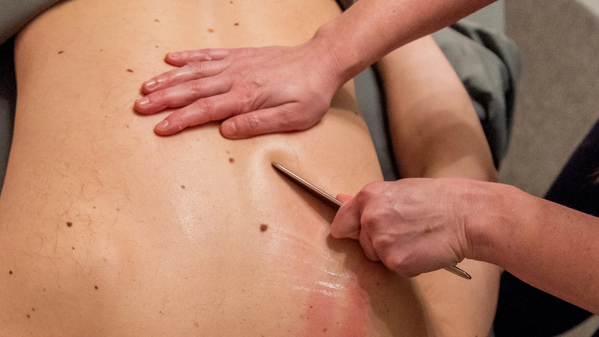 Kasie Lampson, LMT, using a metal IASTM tool on a patient's bare back at REACH Rehab + Chiropractic in Plymouth, MI