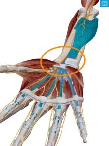 Anatomy picture displaying Carpal Tunnel Syndrome